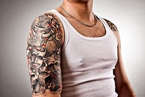 Laser Tattoo Removal | Future You Cosmetic Clinic